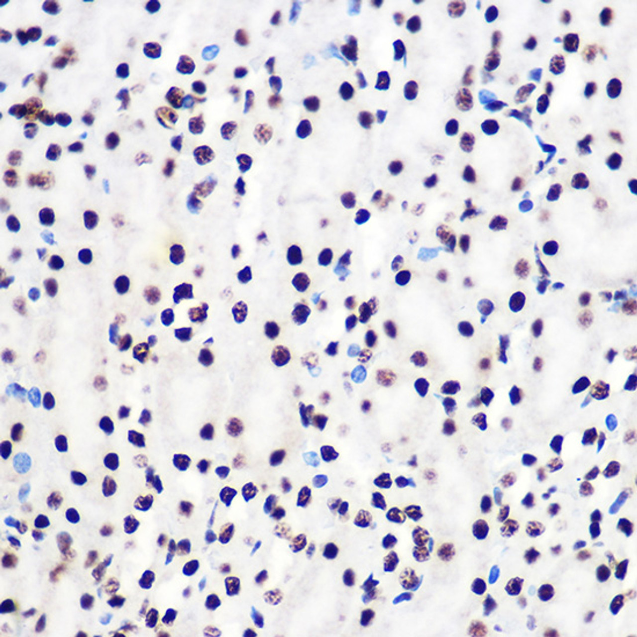 Immunohistochemistry of paraffin-embedded Mouse kidney using Phospho-Smad2（S465/467）/Smad3（S423/425) Polyclonal Antibody at dilution of  1:100 40x lens).