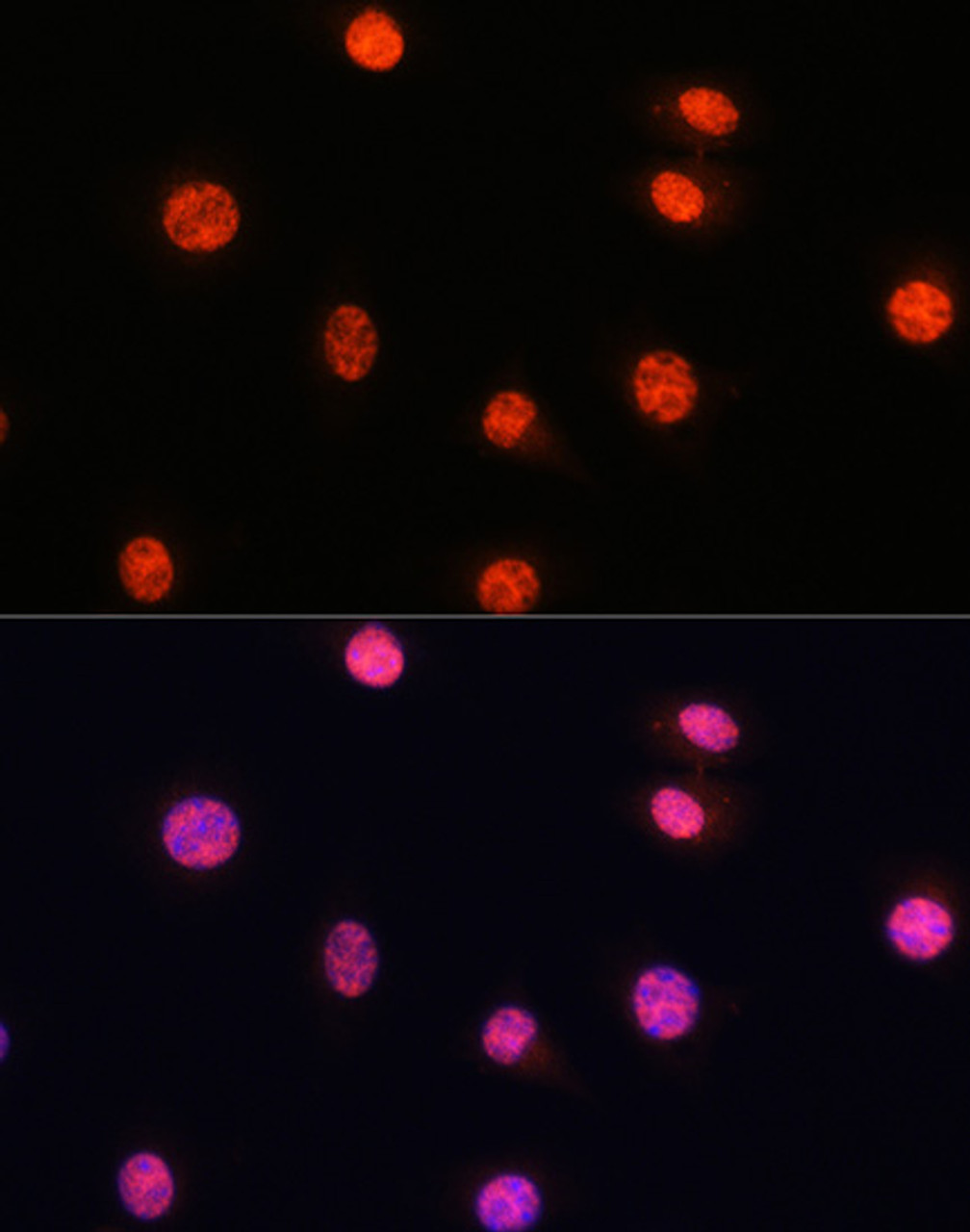 Immunofluorescence analysis of L929 cells using Phospho-Smad2（S465/467）/Smad3（S423/425) Polyclonal Antibody at dilution of  1:100. Blue: DAPI for nuclear staining.