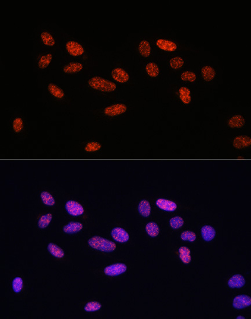 Immunofluorescence analysis of U2OS cells using Phospho-Smad2（S465/467）/Smad3（S423/425) Polyclonal Antibody at dilution of  1:100. Blue: DAPI for nuclear staining.