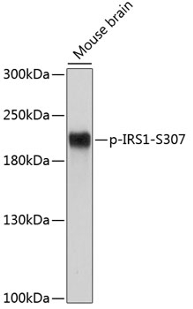 Western blot analysis of extracts of Mouse brain using Phospho-IRS1(S307) Polyclonal Antibody at dilution of 1:500.