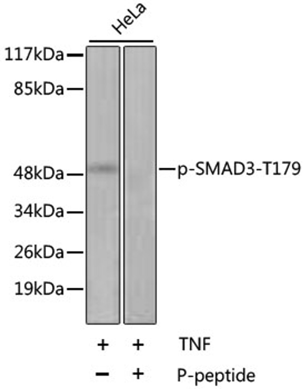 Western blot analysis of extracts of HeLa cell line using Phospho-SMAD3(T179) Polyclonal Antibody.