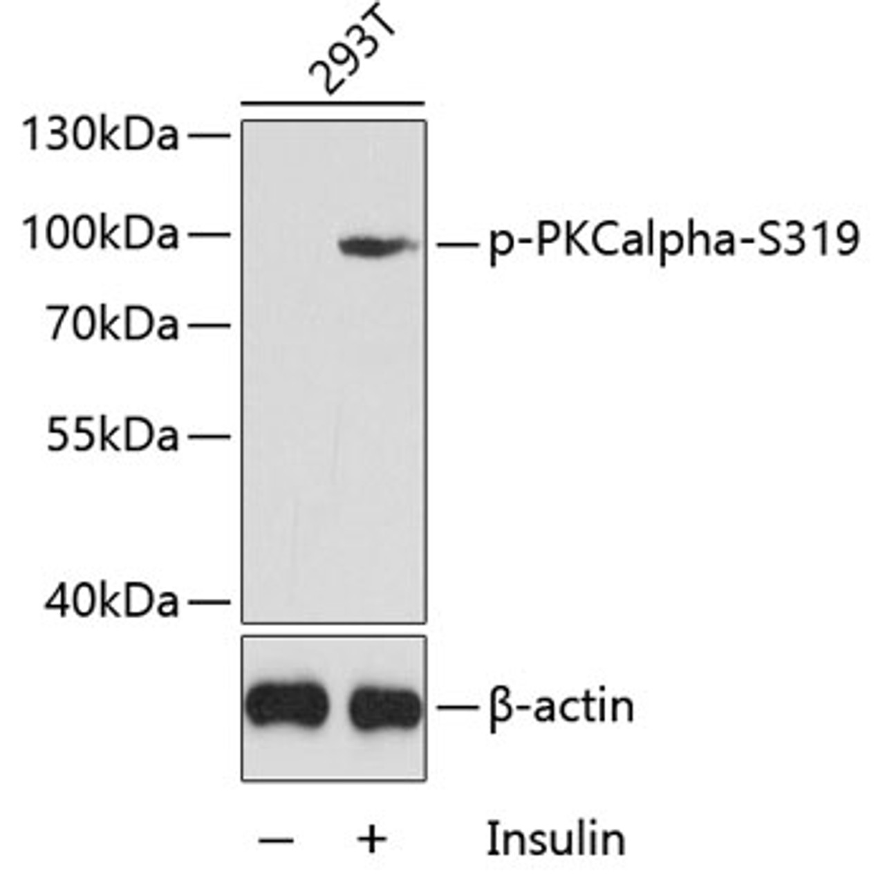 Western blot analysis of extracts of 293T cells using Phospho-PKCalpha(S319) Polyclonal Antibody.
