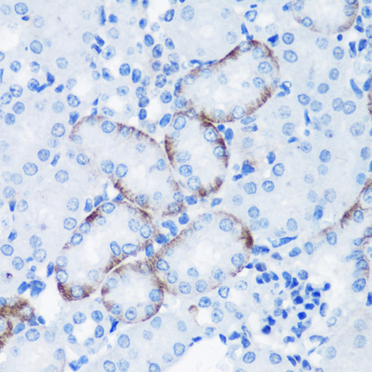 Immunohistochemistry of paraffin-embedded Mouse kidney using Phospho-P70 S6K(T389) Polyclonal Antibody at dilution of  1:100 (40x lens).