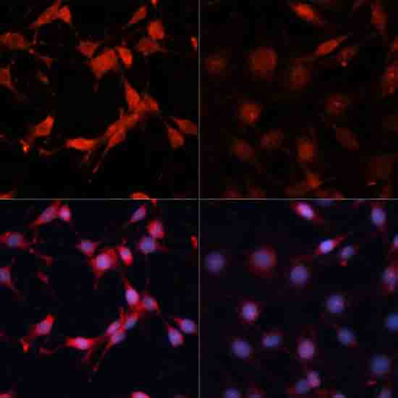 Immunofluorescence analysis of C6 cells using Phospho-P70 S6K(T389) Polyclonal Antibody at dilution of  1:100. C6 cells were treated by Serum-starvation overnight at 37℃.