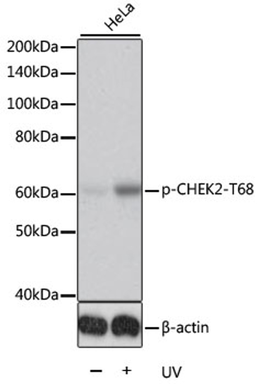 Western blot analysis of extracts of HeLa cells using Phospho-CHEK2(T68) Polyclonal Antibody.