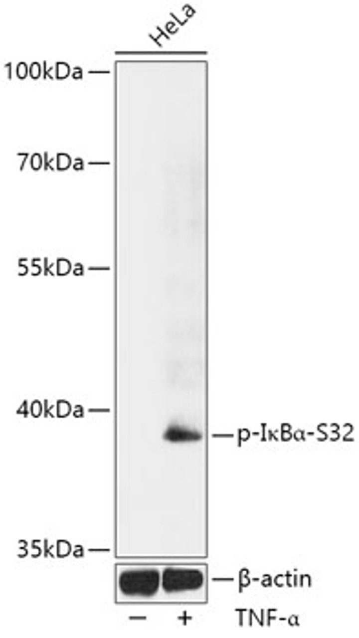 Western blot analysis of extracts of HeLa cells using Phospho-NFKBIA(S32) Polyclonal Antibody at dilution of 1:1000. HeLa cells were treated by TNF-α (20 ng/ml) at 37°C for 30 minutes.