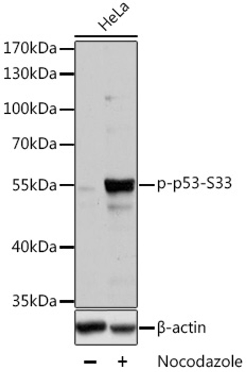 Western blot analysis of extracts of HT-29 cells using Phospho-p53(S33) Polyclonal Antibody at dilution of 1:2000. HT-29 cells were treated by Nocodazole (100ng/mL) for 16 hours.