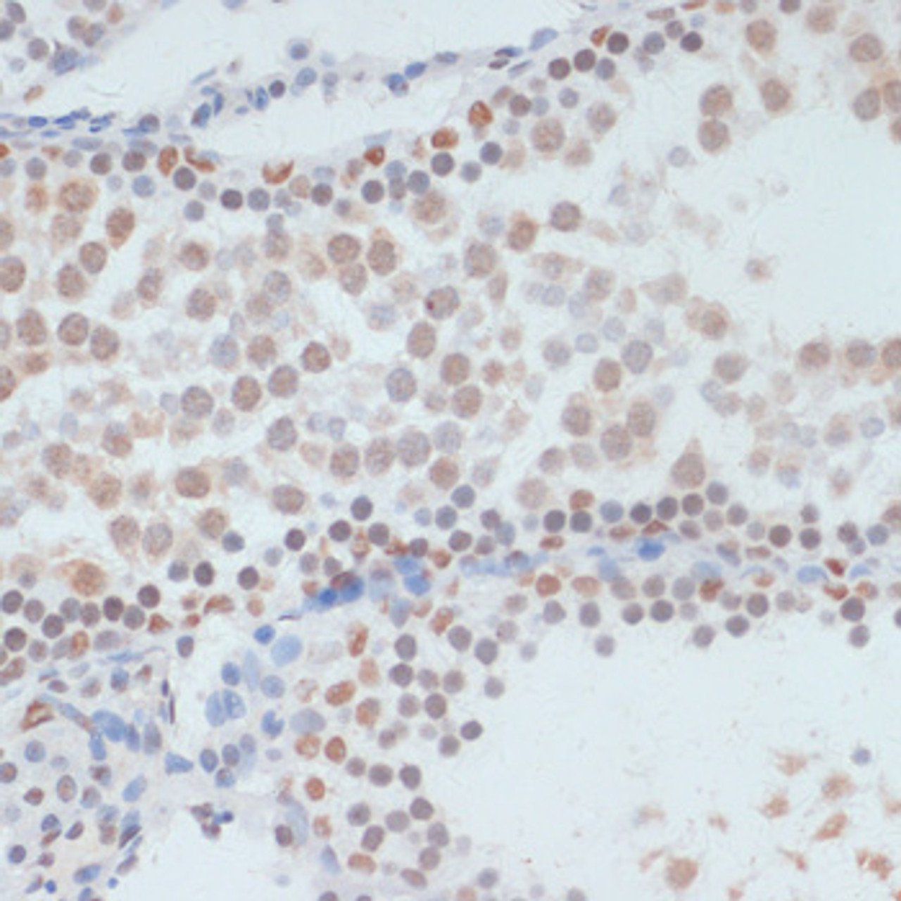 Immunohistochemistry of paraffin-embedded Rat testis using Phospho-p53(S33) Polyclonal Antibody at dilution of  1:100 (40x lens).