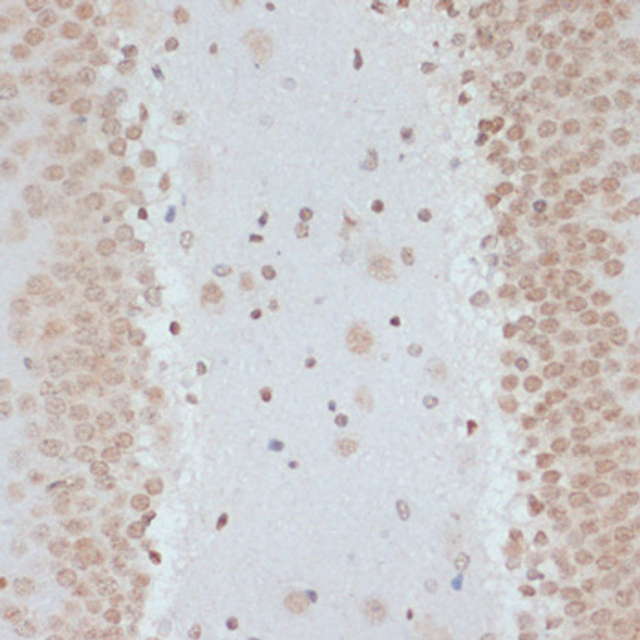 Immunohistochemistry of paraffin-embedded Rat brain using Phospho-p53(S33) Polyclonal Antibody at dilution of  1:100 (40x lens).