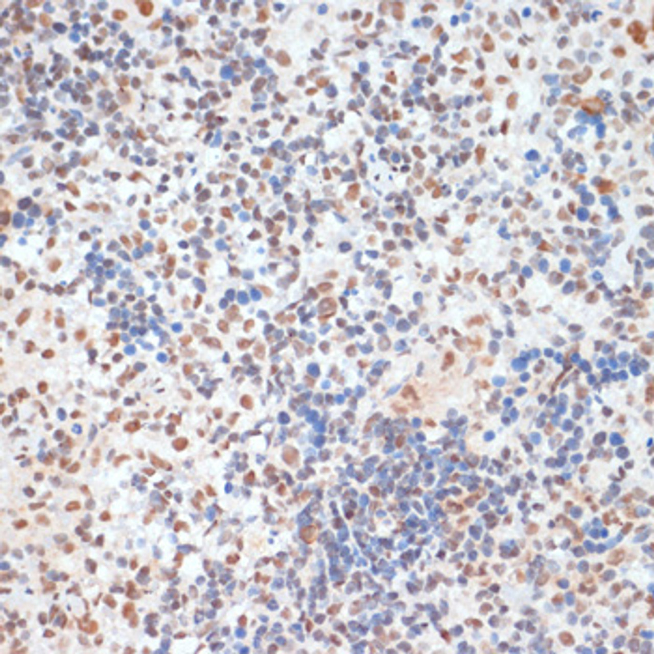 Immunohistochemistry of paraffin-embedded Rat spleen using Phospho-p53(S33) Polyclonal Antibody at dilution of  1:100 (40x lens).