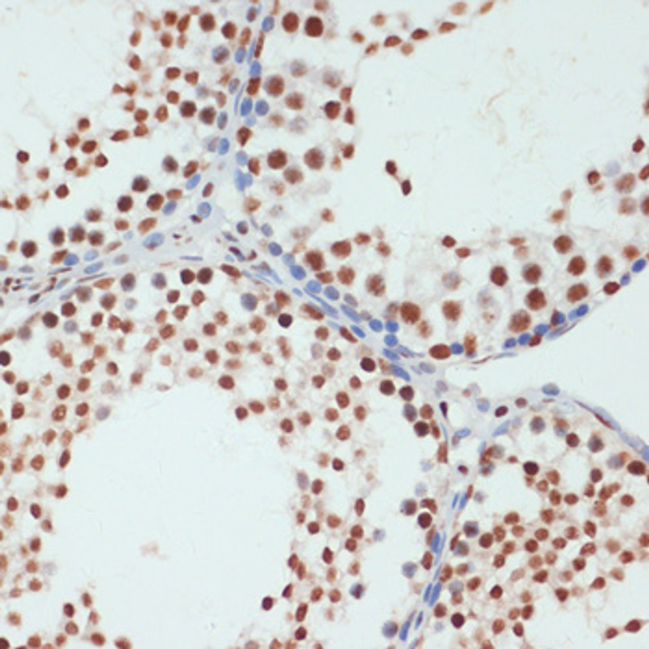 Immunohistochemistry of paraffin-embedded Rat testis using Phospho-POLR2A(S5) Polyclonal Antibody at dilution of  1:100 (40x lens).