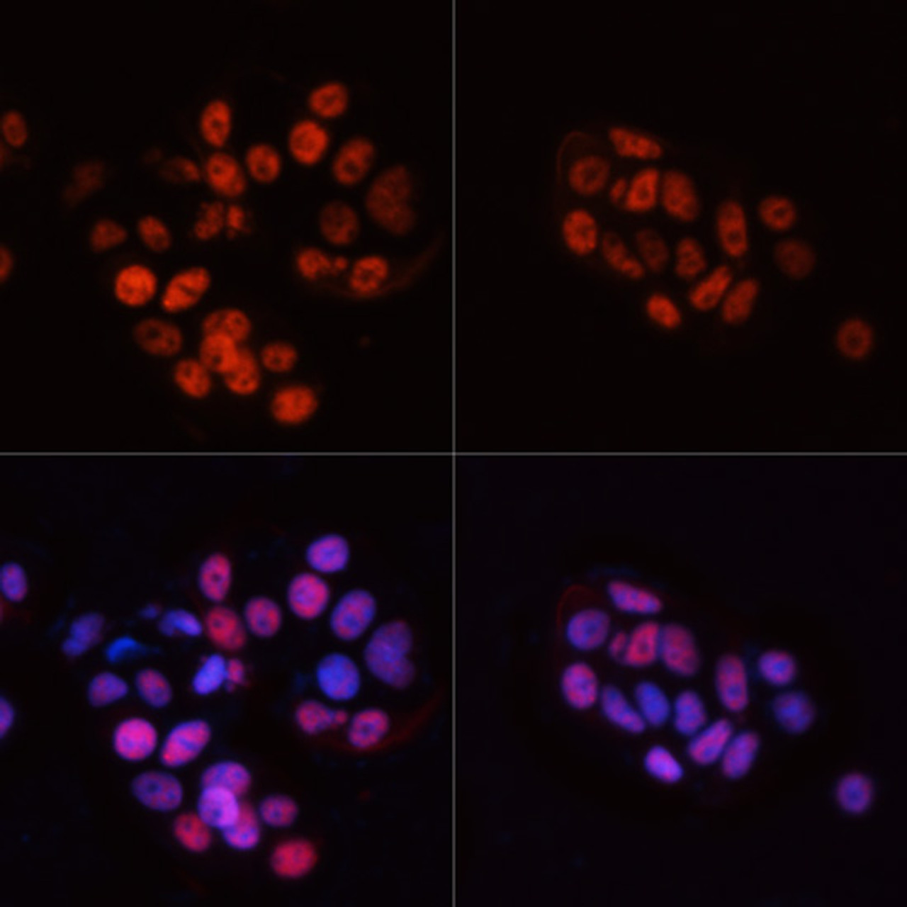 Immunofluorescence analysis of MCF7 cells using Phospho-POLR2A(S5) Polyclonal Antibody at dilution of  1:100. MCF7 cells were treated by nocodazole (50 ng/ml) at 37℃ for 20 hours (left). Blue: DAPI for nuclear staining.