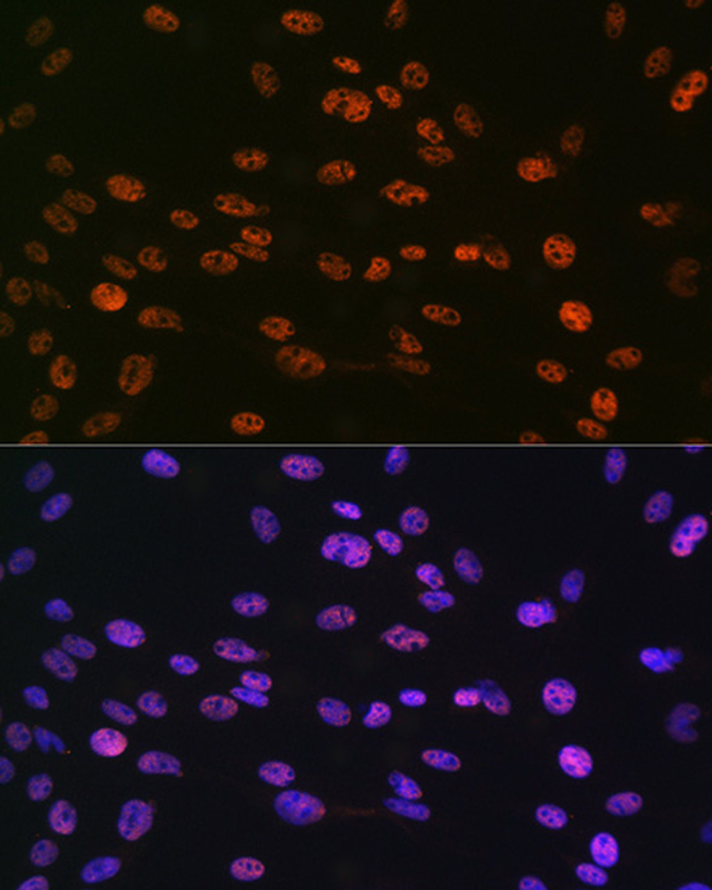 Immunofluorescence analysis of C6 cells using Phospho-Histone H3(S10) Polyclonal Antibody at dilution of  1:100 (40x lens). Blue: DAPI for nuclear staining.
