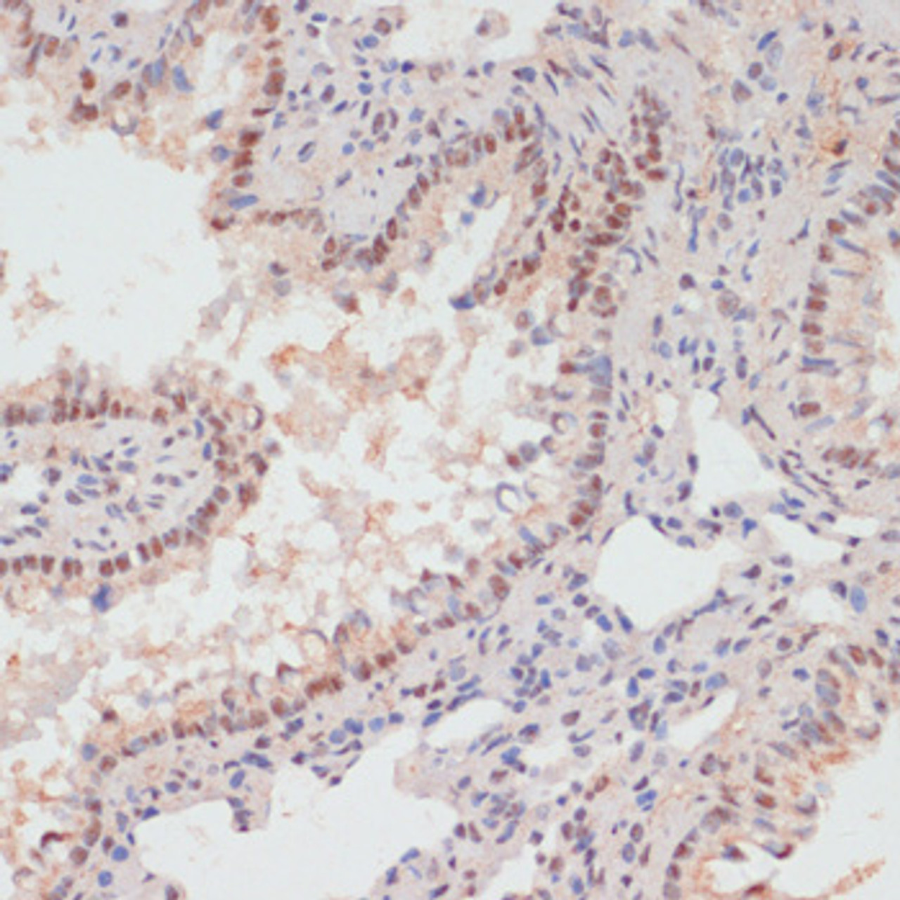 Immunohistochemistry of paraffin-embedded Rat lung using Phospho-PEA15(S104) Polyclonal Antibody at dilution of  1:100 (40x lens).