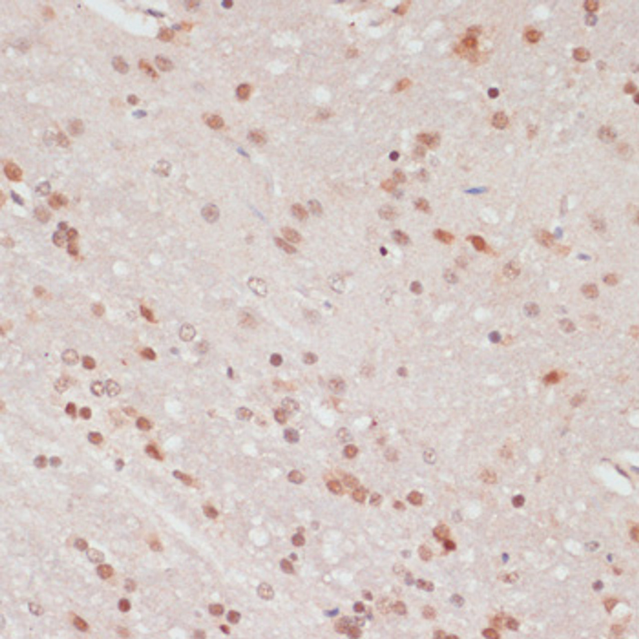 Immunohistochemistry of paraffin-embedded Rat brain using Phospho-PEA15(S104) Polyclonal Antibody at dilution of  1:100 (40x lens).