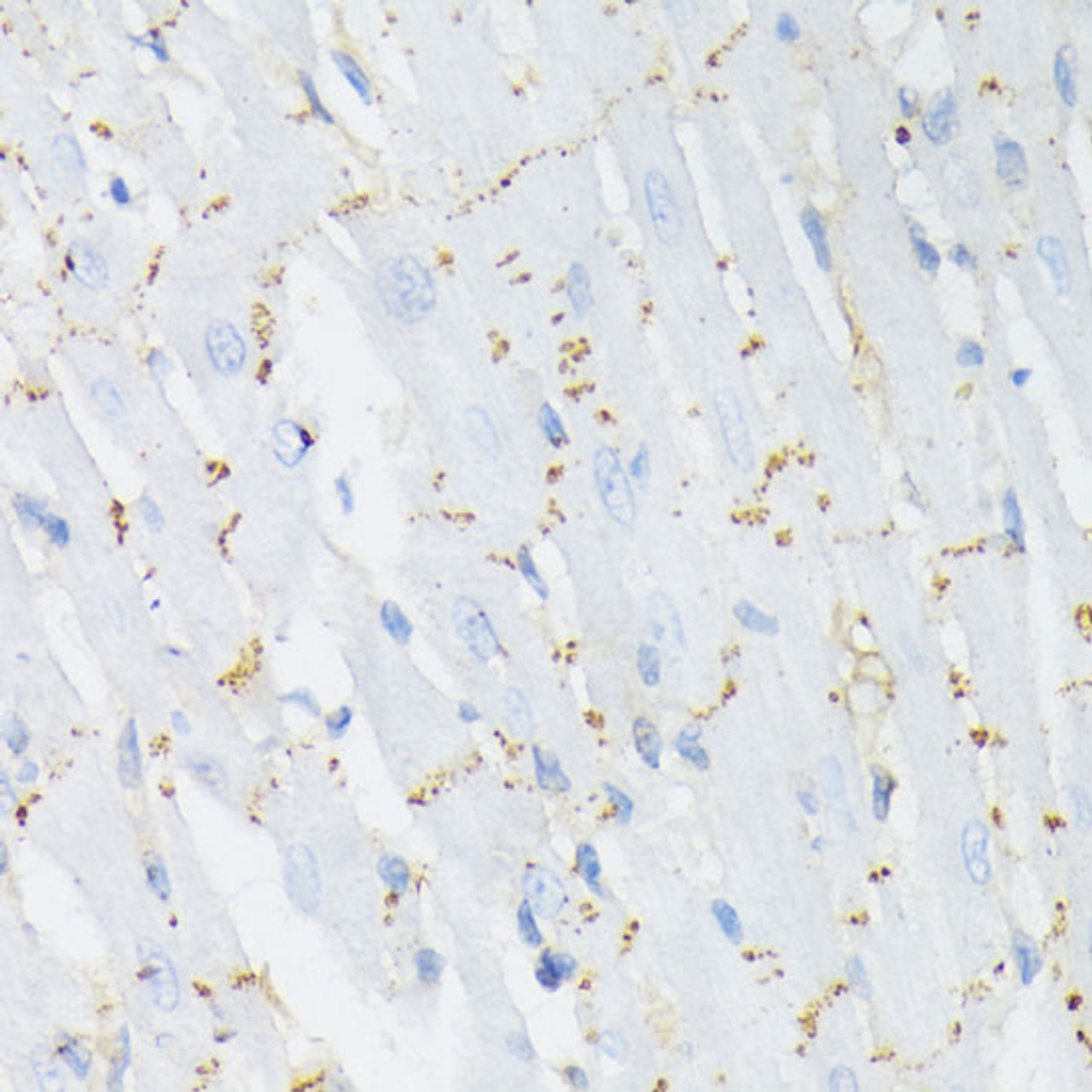 Immunohistochemistry of paraffin-embedded Rat heart using Phospho-GJA1(S368) Polyclonal Antibody at dilution of  1:200 (40x lens).