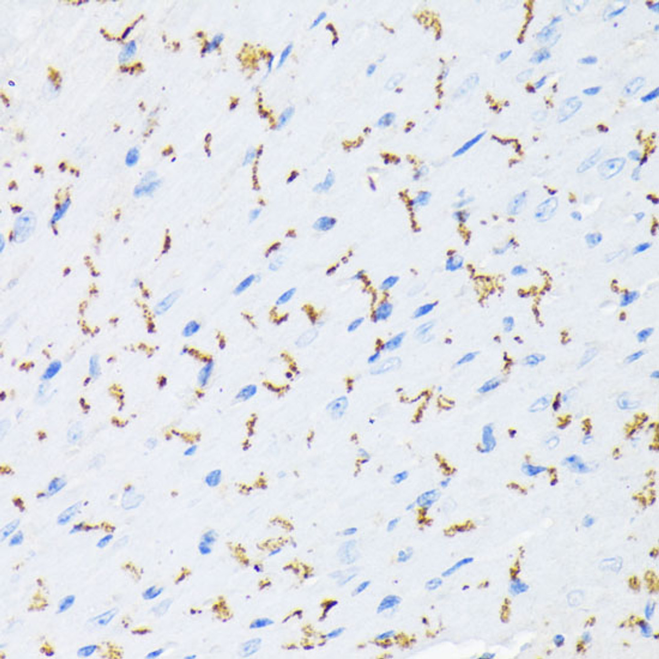 Immunohistochemistry of paraffin-embedded Mouse heart using Phospho-GJA1(S368) Polyclonal Antibody at dilution of  1:200 (40x lens).