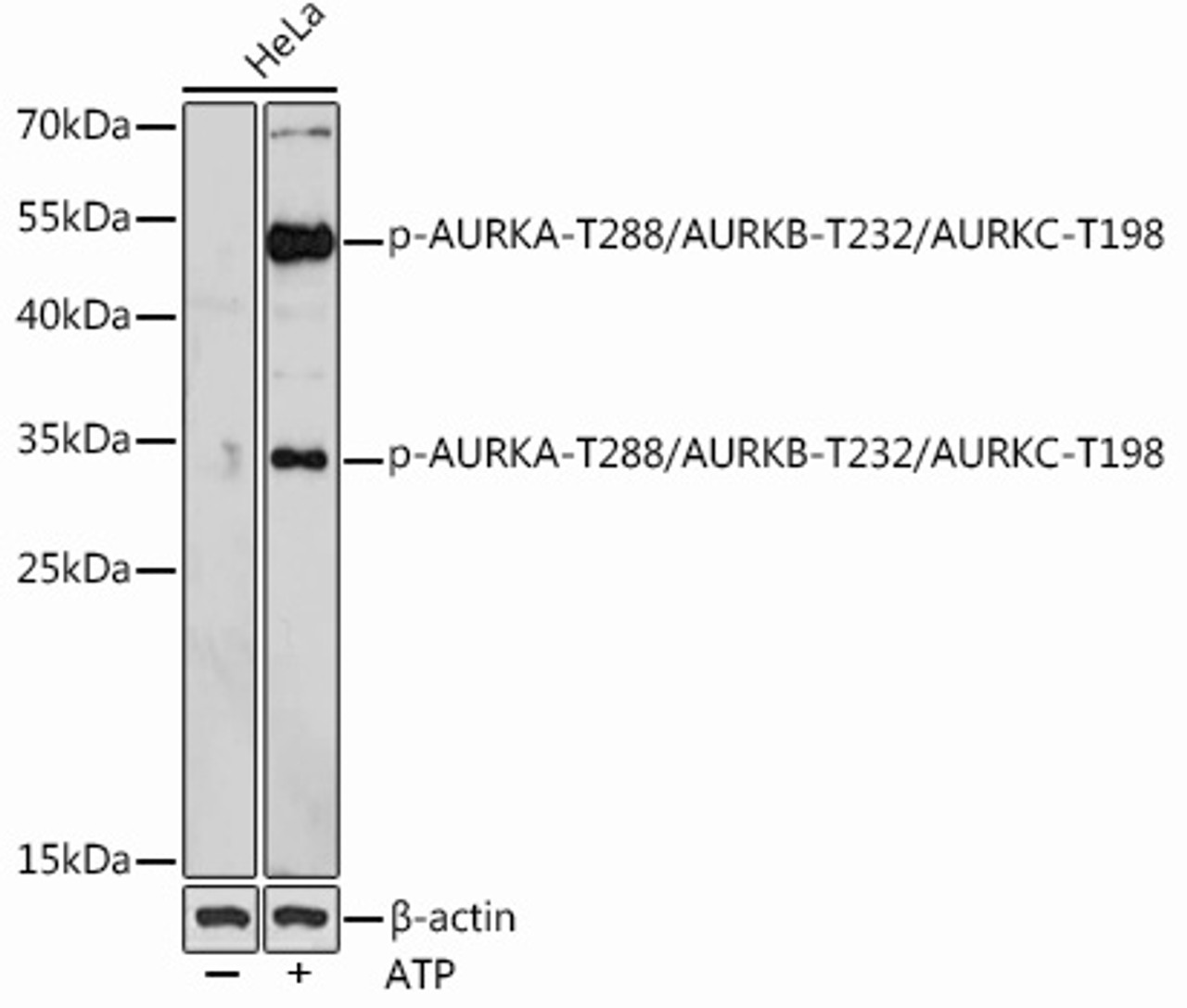 Western blot analysis of extracts of HeLa cells using Phospho-AURKA(T288)/AURKB(T232)/AURKC(T198) Polyclonal Antibody at dilution of 1:1000. Hela cells were treated by ATP(5 mM) at 30°C for 1 hour.
