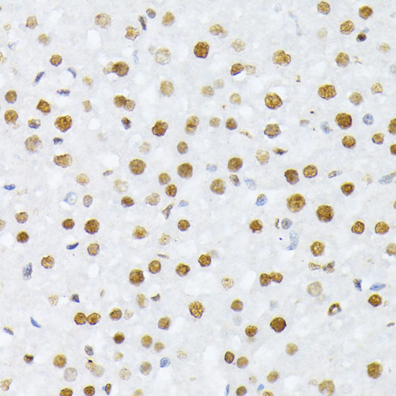 Immunohistochemistry of paraffin-embedded Rat liver using Phospho-Histone H2A(S129) Polyclonal Antibody at dilution of  1:100 (40x lens).