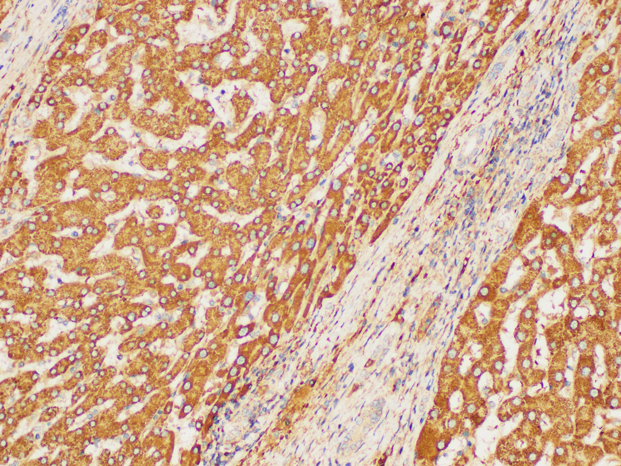 Immunohistochemistry of paraffin-embedded Human liver using CHI3L1 Polycloanl Antibody at dilution of 1:300