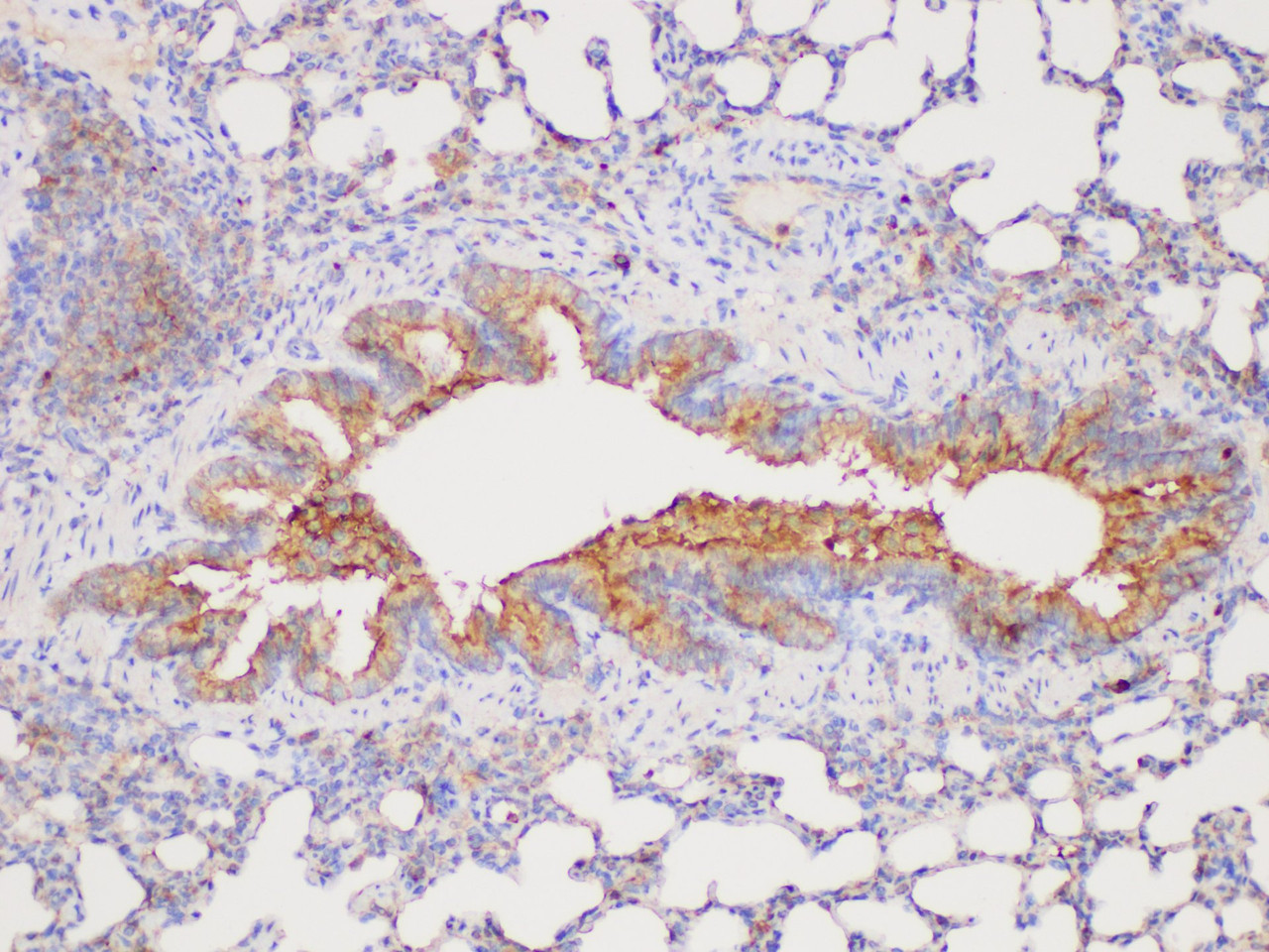 Immunohistochemistry of paraffin-embedded Rat lung using CHI3L1 Polycloanl Antibody at dilution of 1:300