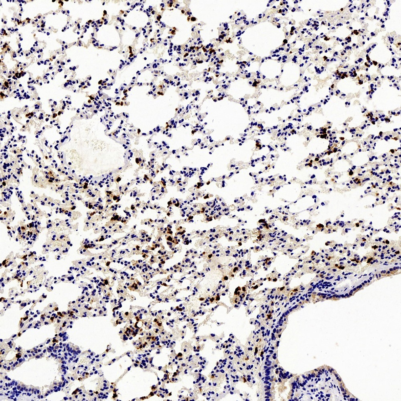 Immunohistochemistry analysis of paraffin-embedded mouse Inflammatory lung  using Ly6g Polyclonal Antibody at dilution of 1:200.