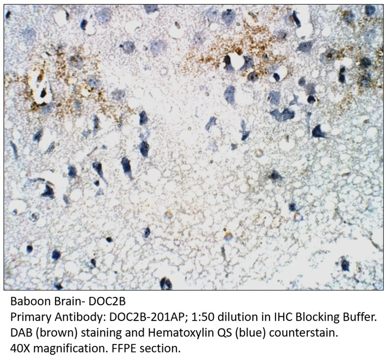DOC2B Antibody from Fabgennix
