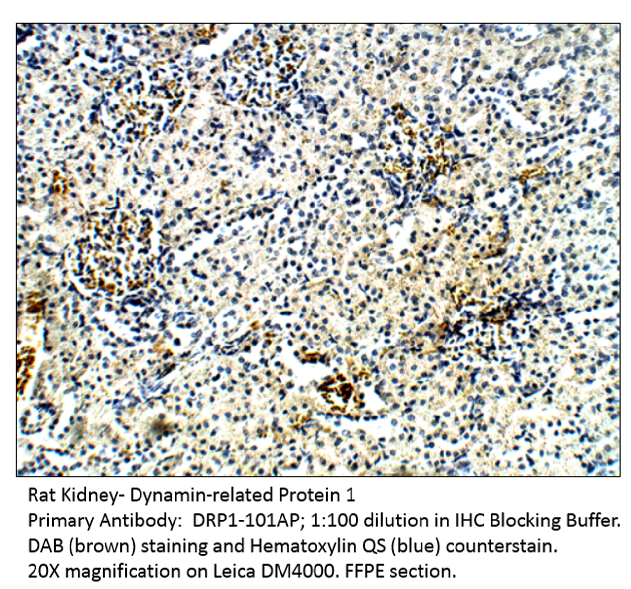 DRP1 Antibody from Fabgennix