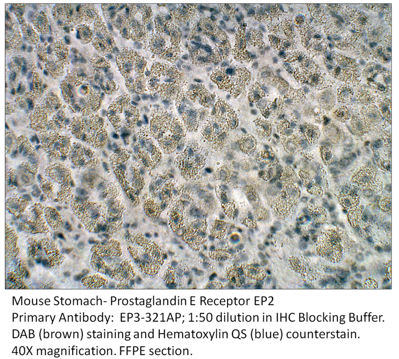 Prostaglandin E Receptor EP2 Antibody from Fabgennix