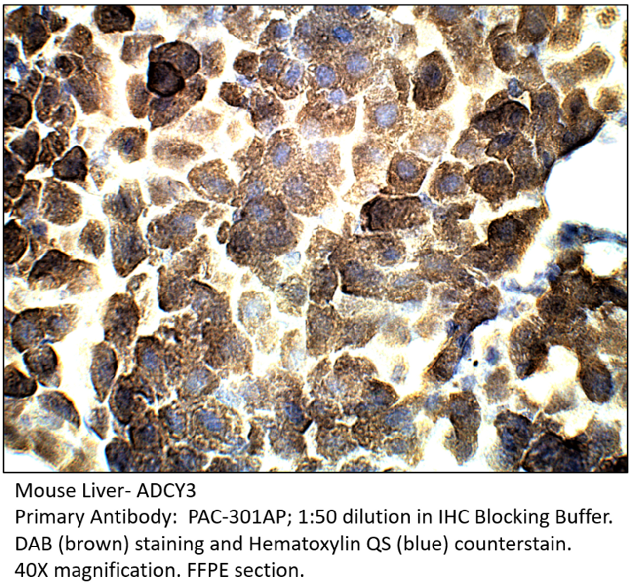 ADCY3 Antibody from Fabgennix