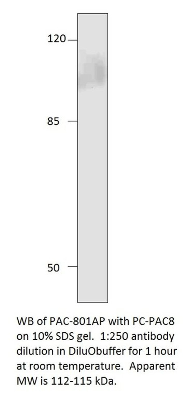 ADCY8 Antibody from Fabgennix