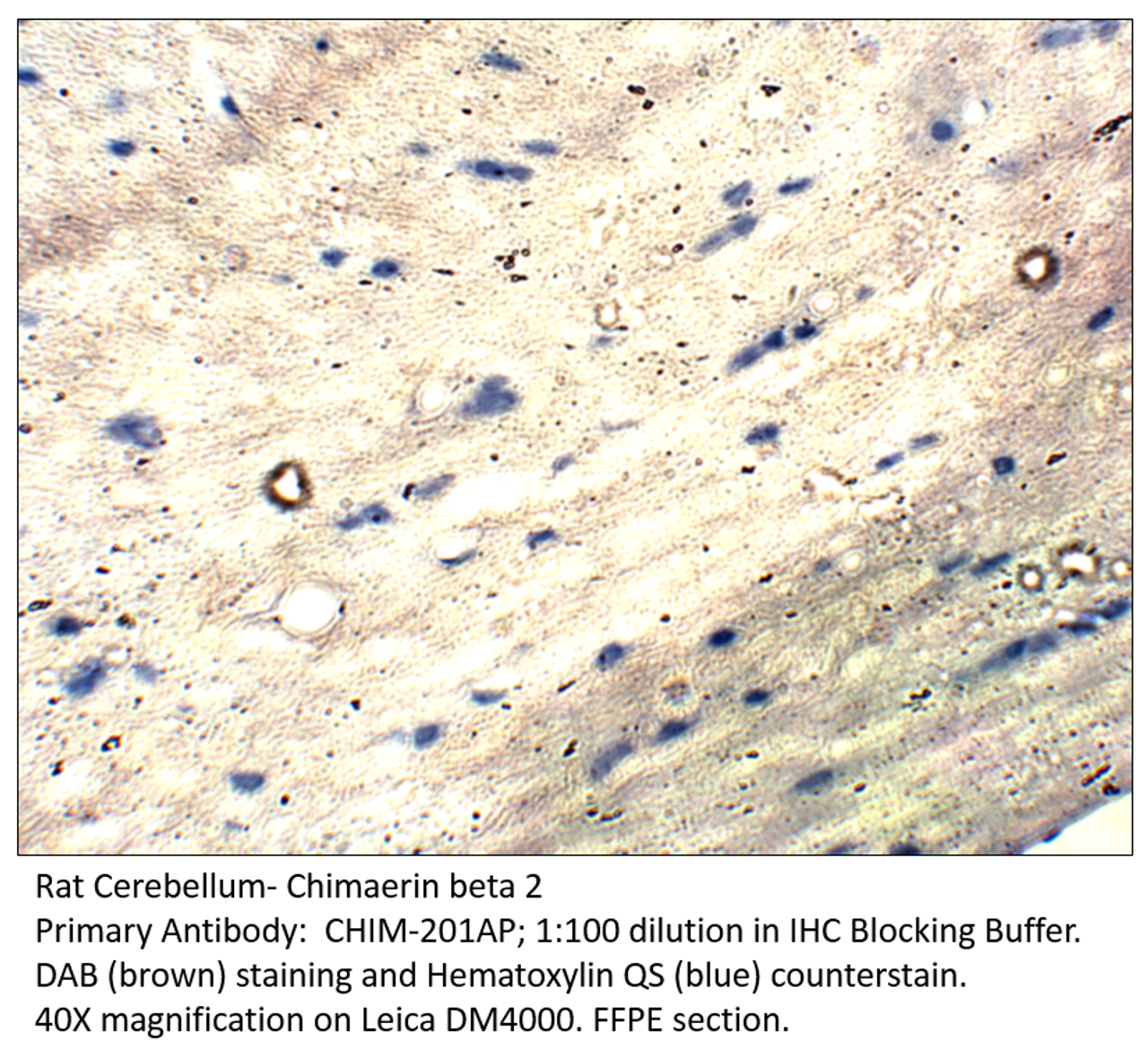 Chimaerin beta 2 Antibody from Fabgennix