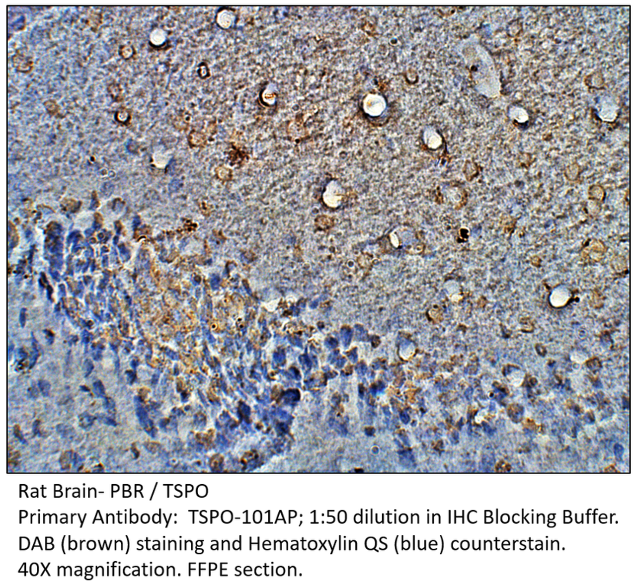 PBR Antibody from Fabgennix