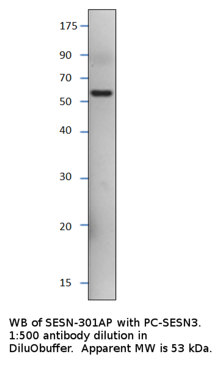 SESN3 Antibody from Fabgennix
