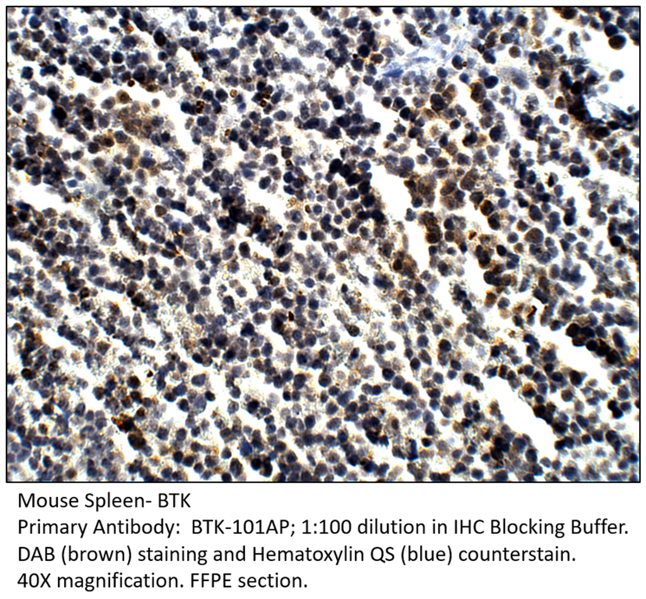 BTK Antibody from Fabgennix