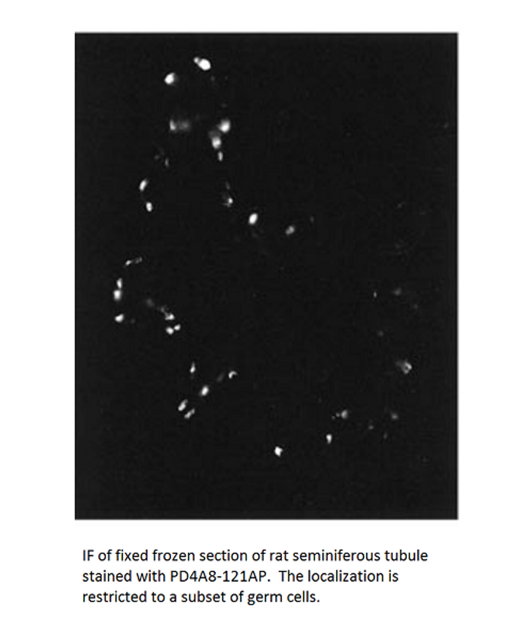 PDE4A8 Antibody from Fabgennix