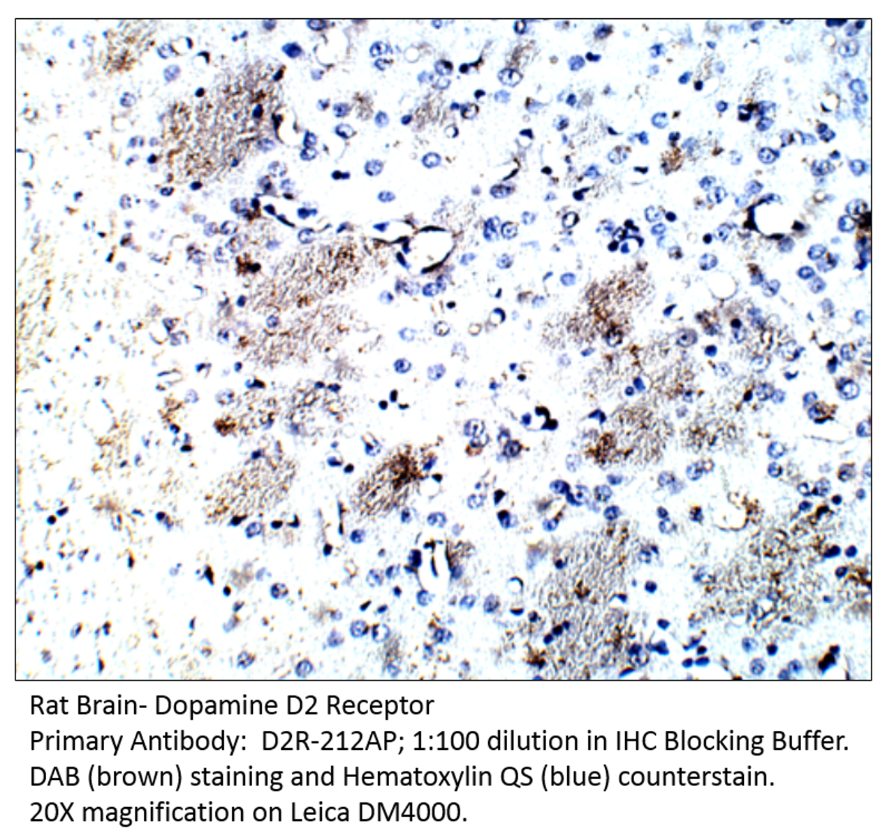 Dopamine D2 Receptor Antibody from Fabgennix