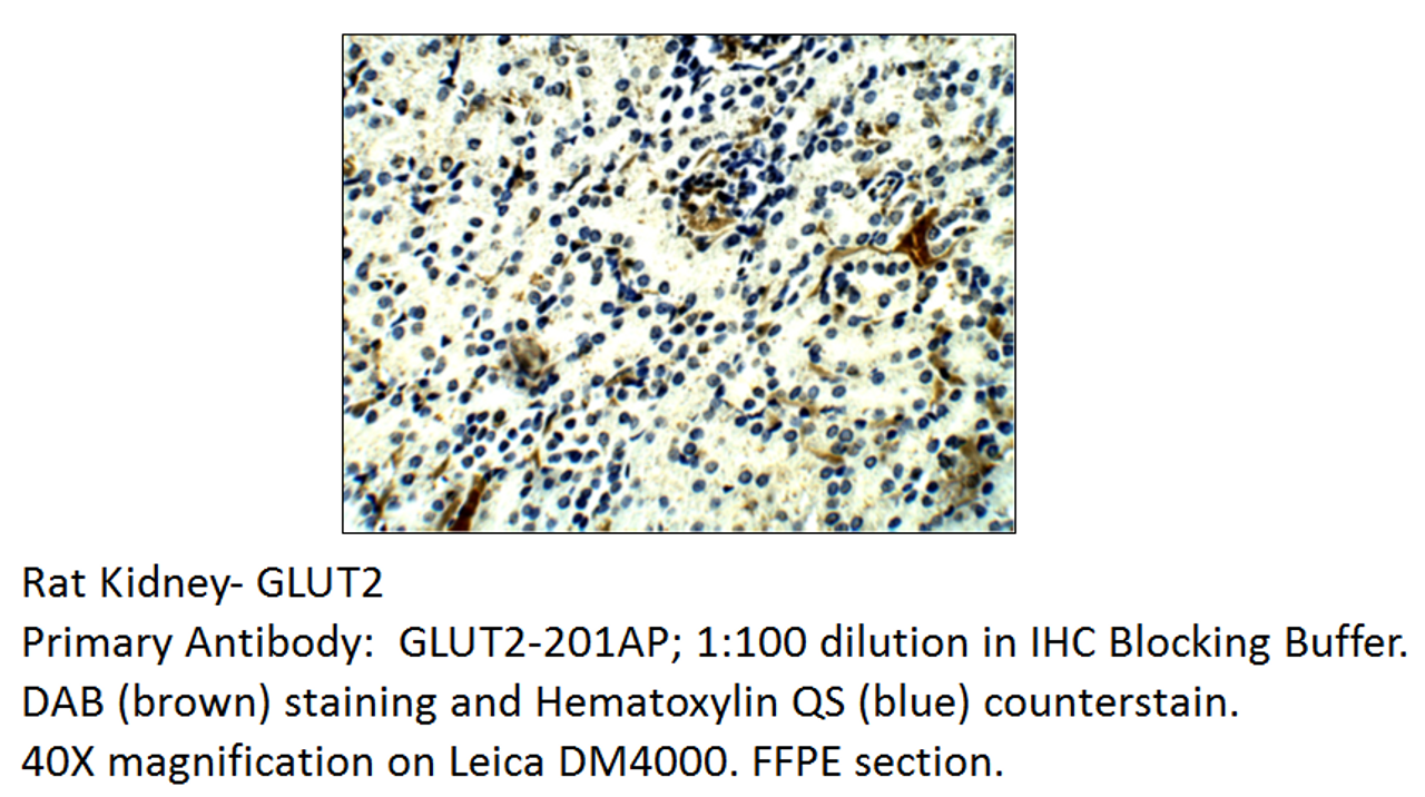 Glucose Transporter GLUT2 Antibody from Fabgennix