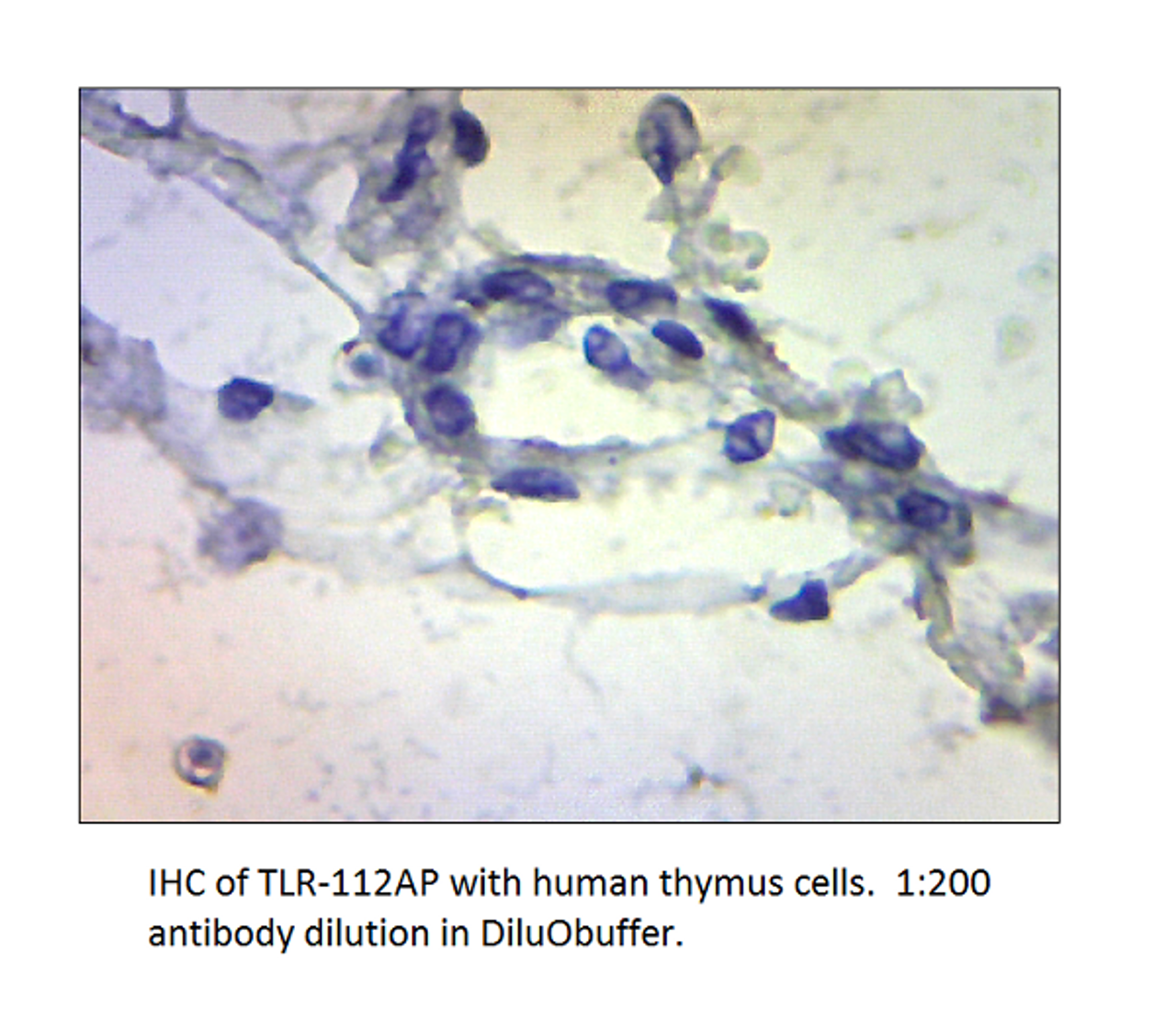 TLR1 Antibody from Fabgennix