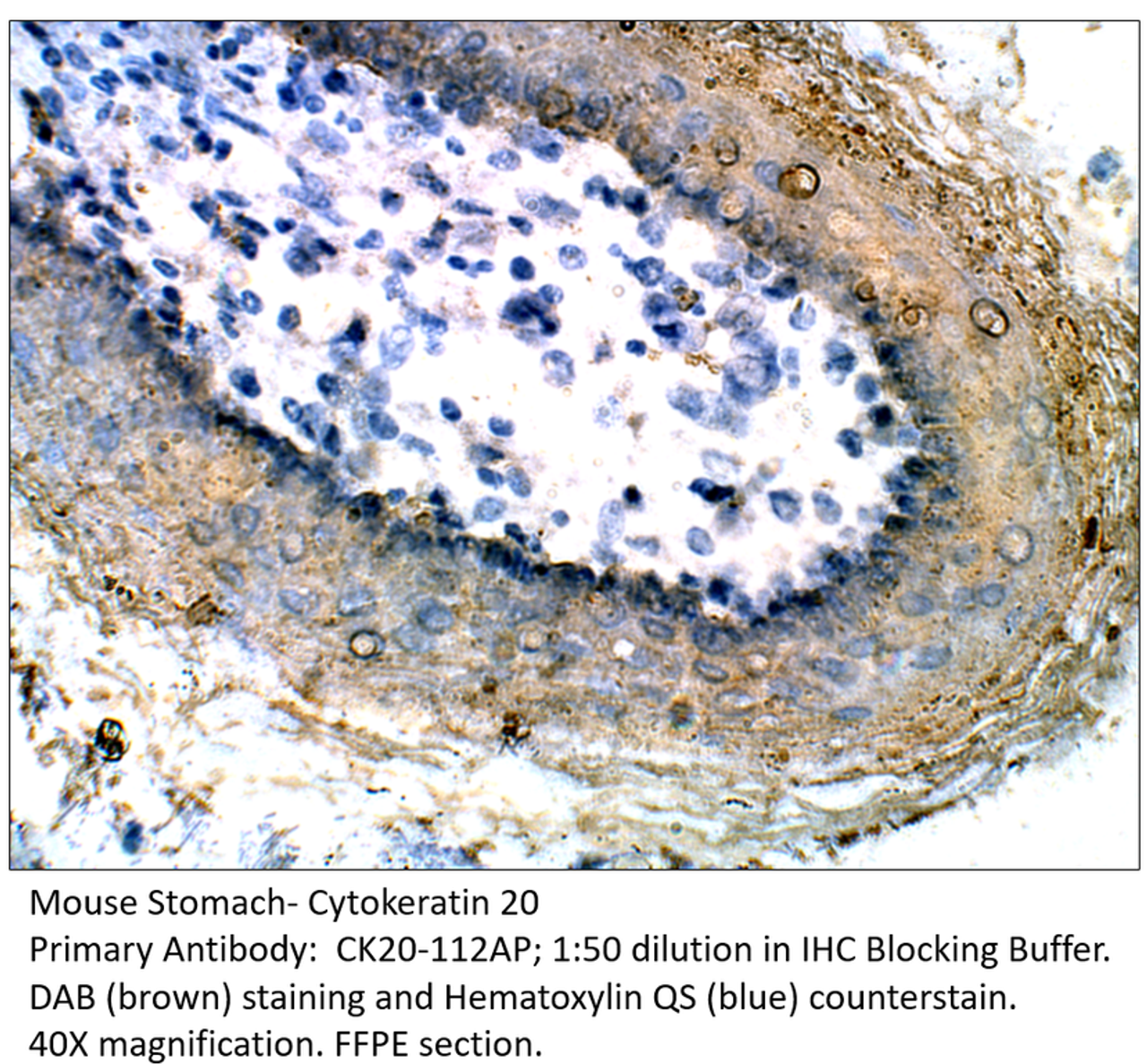 Cytokeratin 20 Antibody from Fabgennix