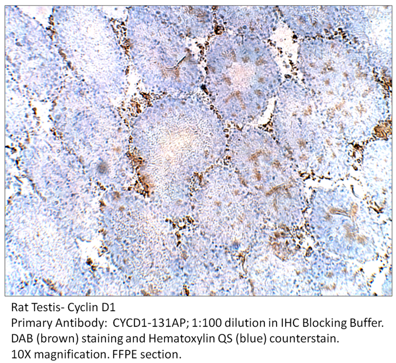 Cyclin D1 Antibody from Fabgennix