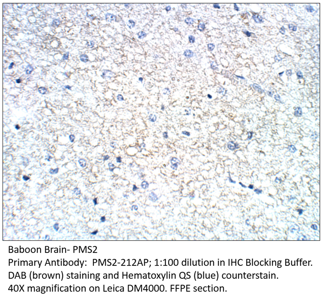 PMS2 Antibody from Fabgennix