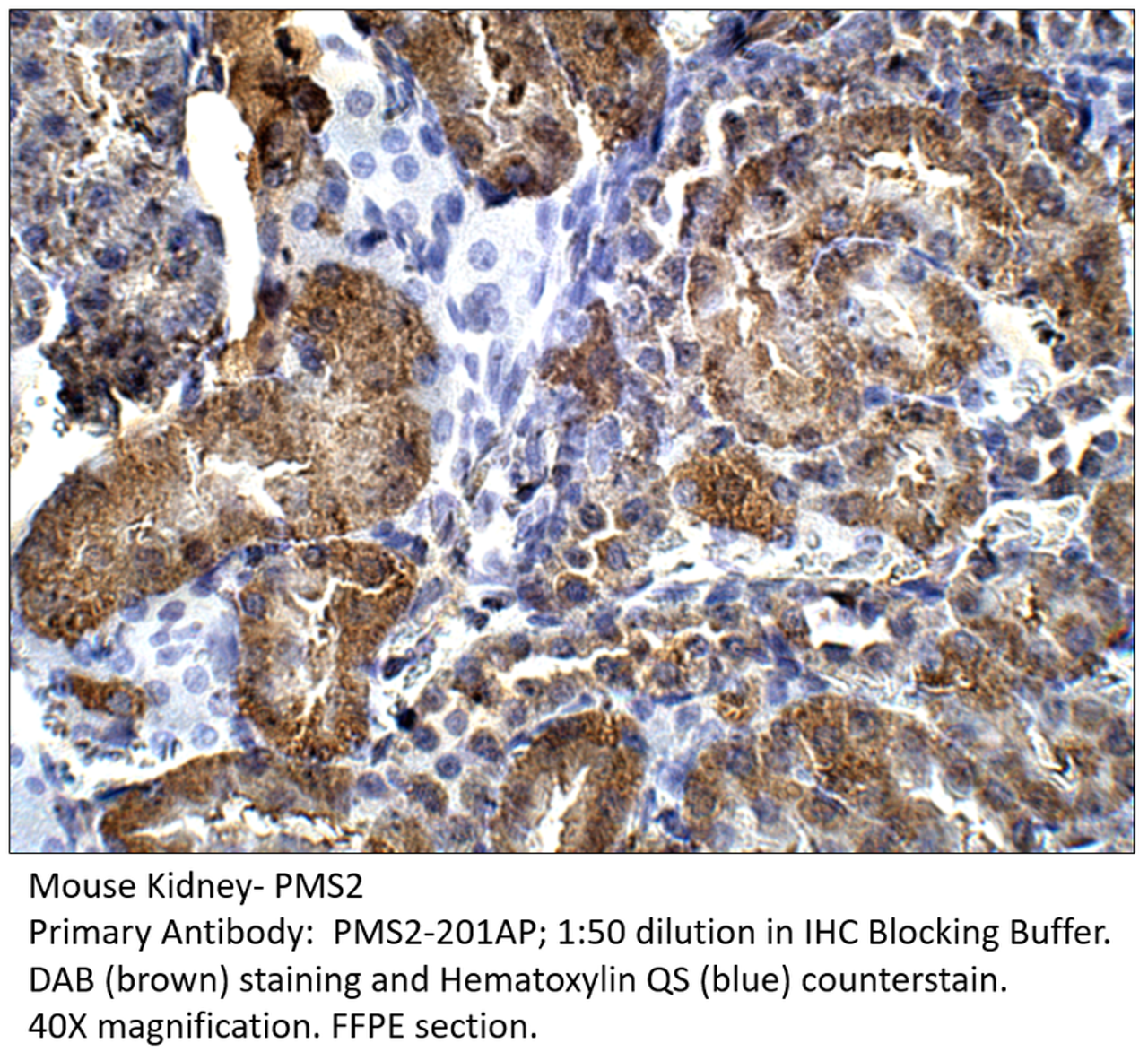 PMS2 Antibody from Fabgennix