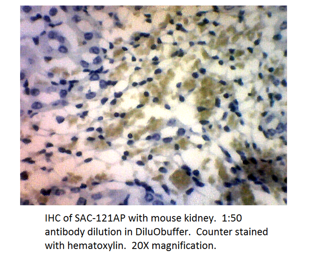 Soluble Adenylate Cyclase 1 Antibody from Fabgennix