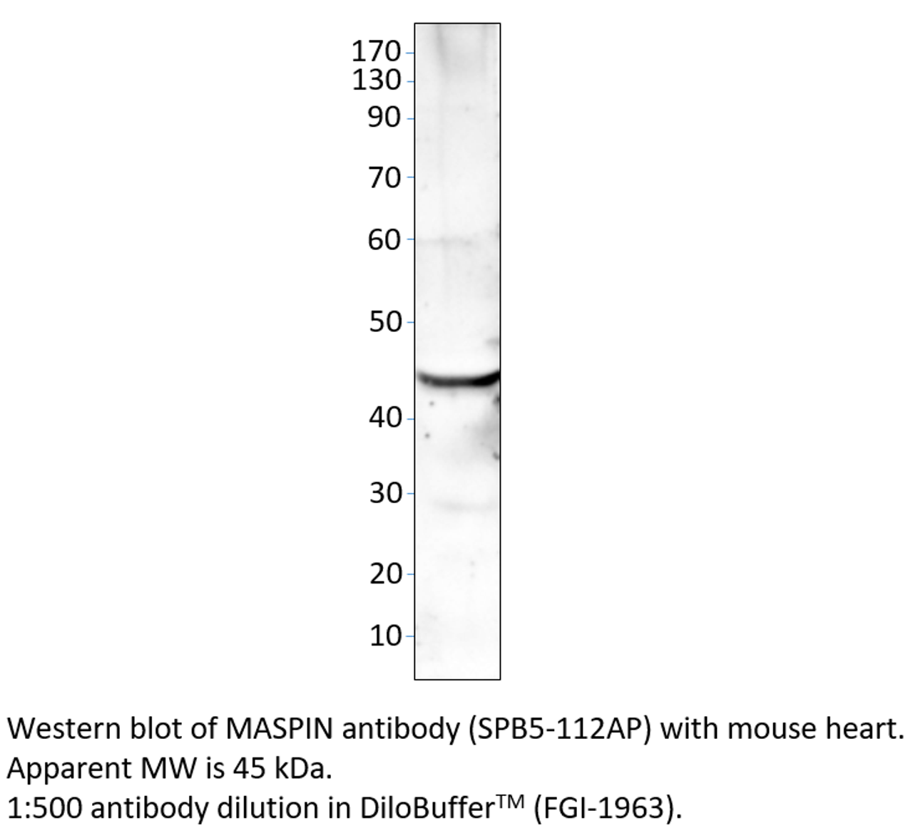 MASPIN Antibody from Fabgennix