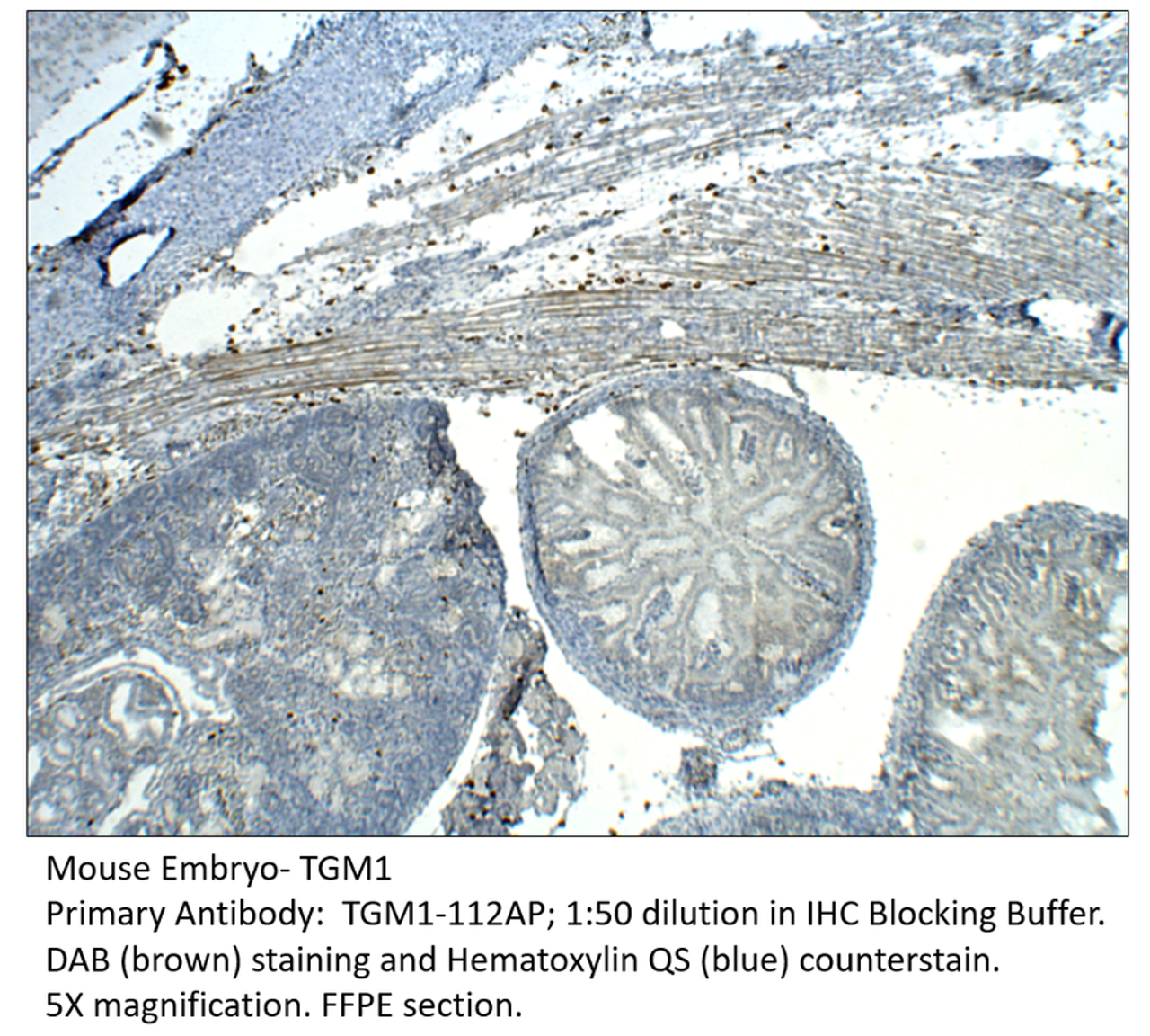 TGM1 Antibody from Fabgennix