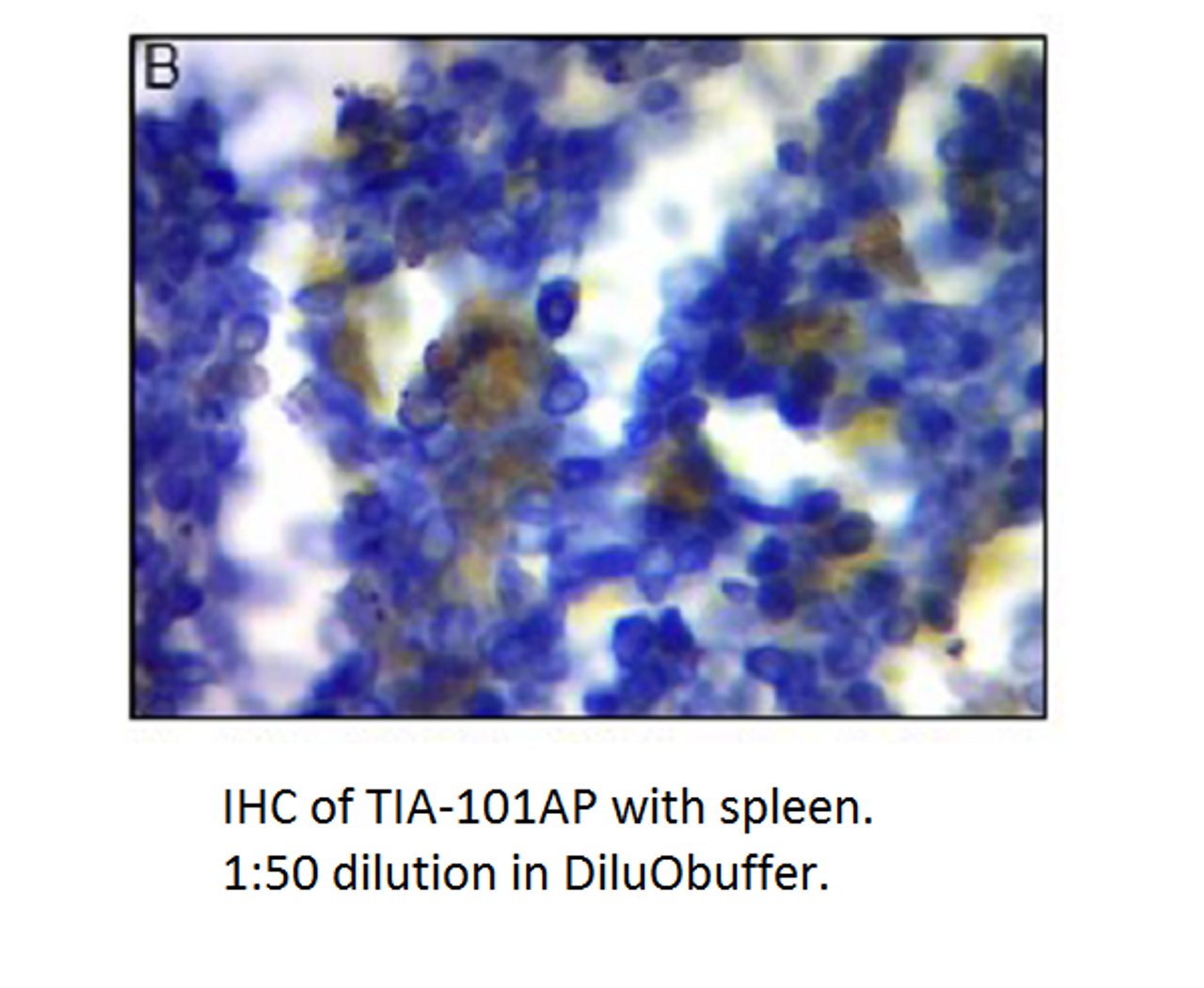 TIA1 Antibody from Fabgennix