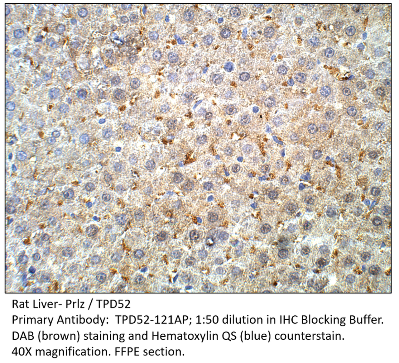 Prlz / TPD52 Antibody from Fabgennix