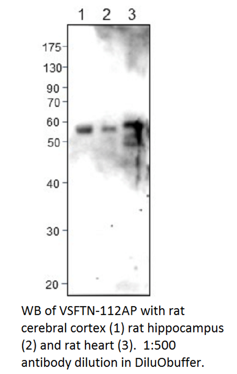 Visfatin Antibody from Fabgennix