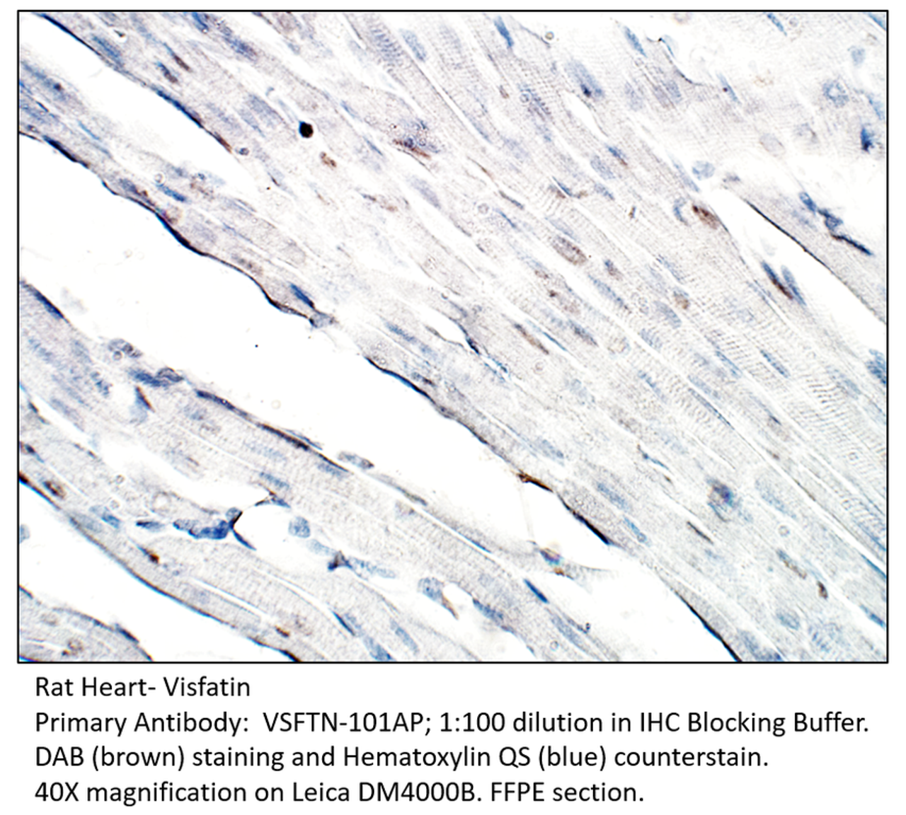 Visfatin Antibody from Fabgennix